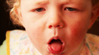 Dane County whooping cough cases highest in more than a decade